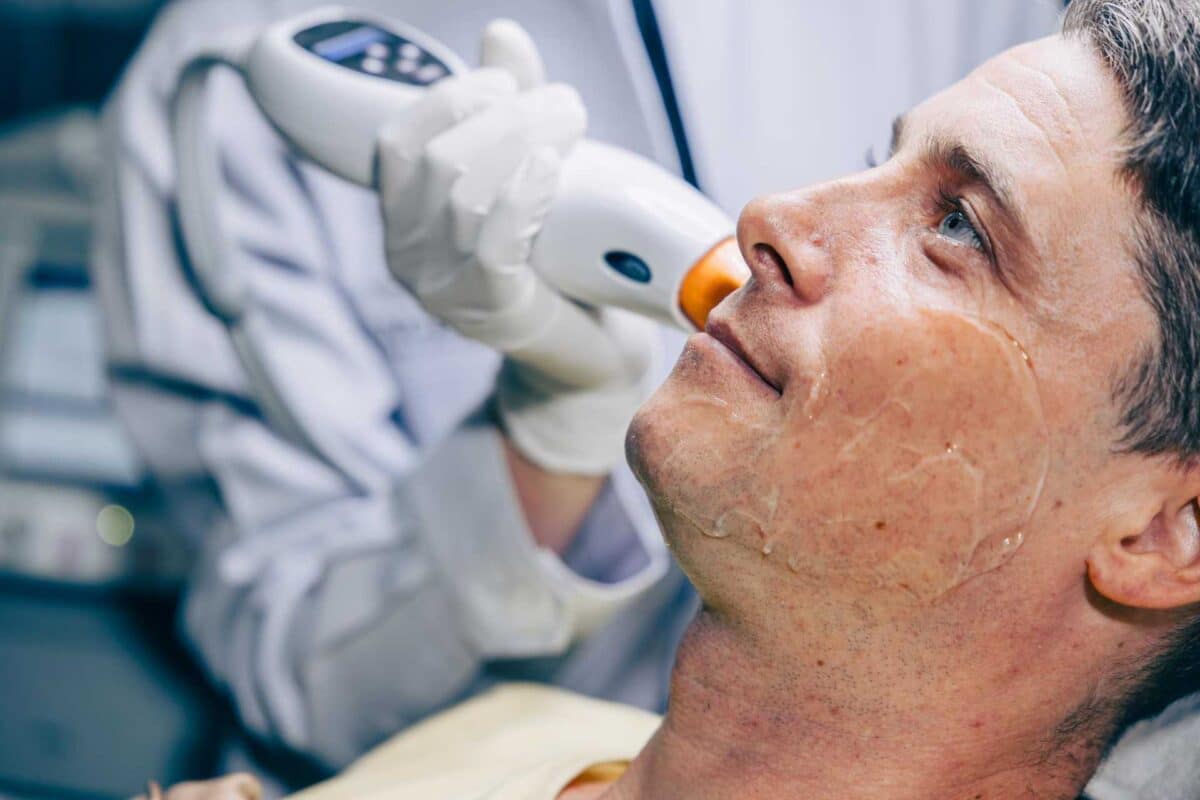 A practitioner in white gloves uses a handheld laser device on a man’s face, which is covered in a clear treatment gel.
