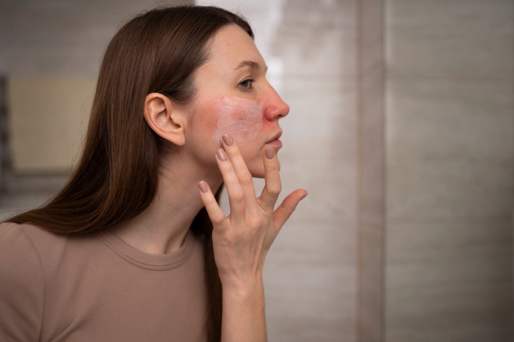 A woman applies cream to her irritated, red cheeks whilst looking in the mirror in a bathroom, addressing redness-of-skin-after-laser-treatment.
