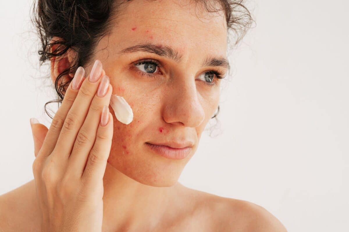 A person applying white cream to their face as part of a skincare routine.