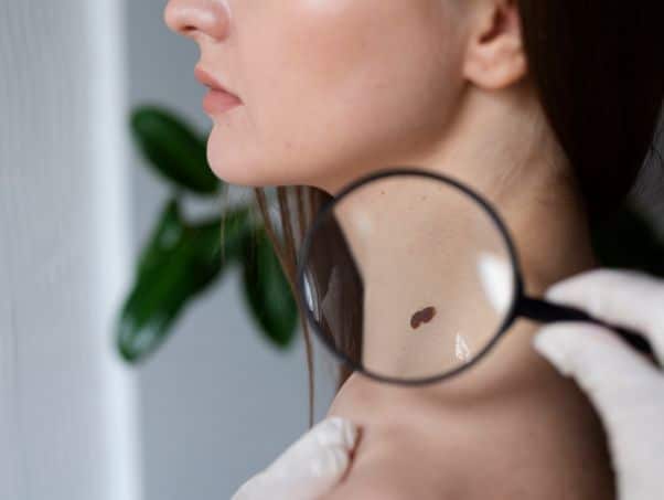 Doctor checking mole on patient's neck for skin cancer.