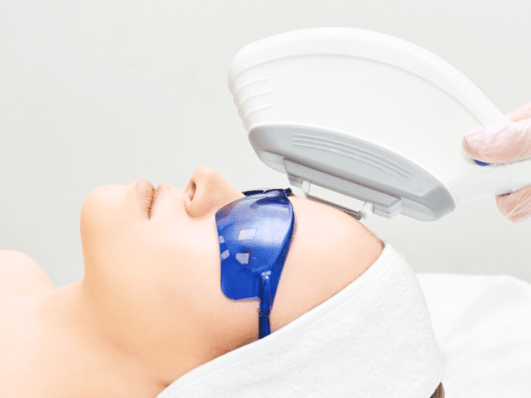 a woman getting IPL treatment for melasma at a clinic