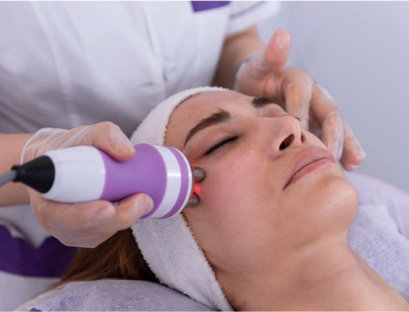 young woman undergoing a facial radiofrequency face lift , skin tightening treatment.